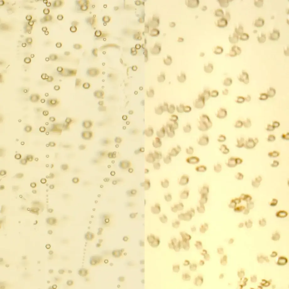 Champagne vs Prosecco